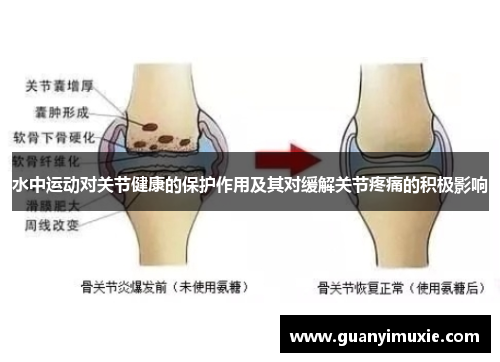 水中运动对关节健康的保护作用及其对缓解关节疼痛的积极影响